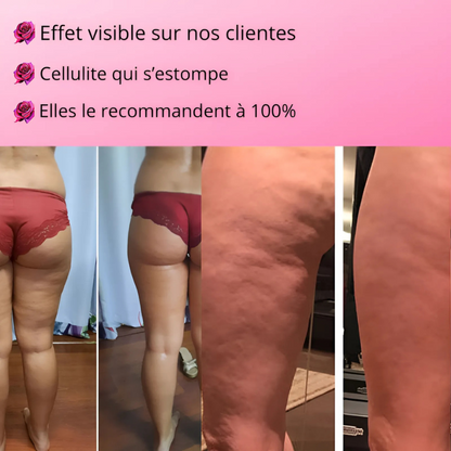 Lynesian™ – Appareil Sculptant 3 en 1 Lisse, raffermit, affine et élimine la cellulite !