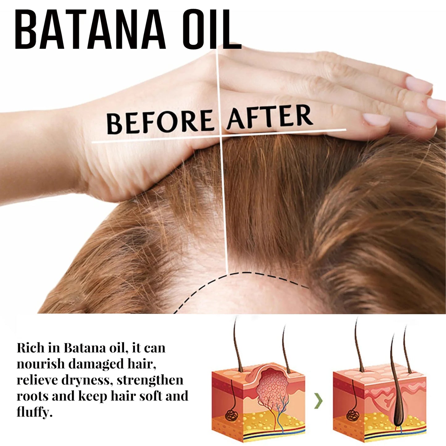 Anti Hair Loss Soap Restore Repair Damaged Hair Scalp Treatment Anti-itch Oil Control Batana Herbal Hair Growth Shampoo Bar